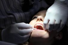 1万年后人类就曾经开端牙齿医治了?