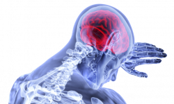 什么是脑中风-脑中风预防-脑中风治疗方法