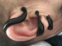 耳鸣是什么原因引起的-耳鸣的治疗方法